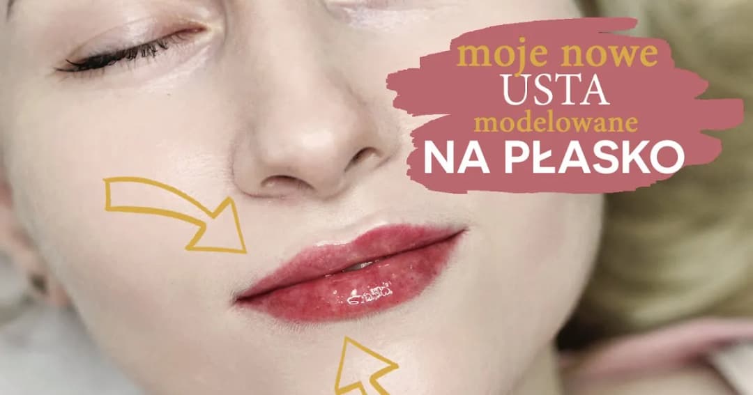 Ile kosztuje 1 ml kwasu hialuronowego? Sprawdź ceny i czynniki wpływające na koszt